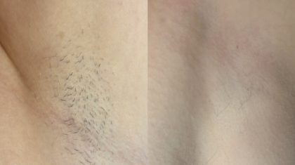 2025_07_22-Zomer-bij-Purife-stralend-glad-en-helemaal-jij