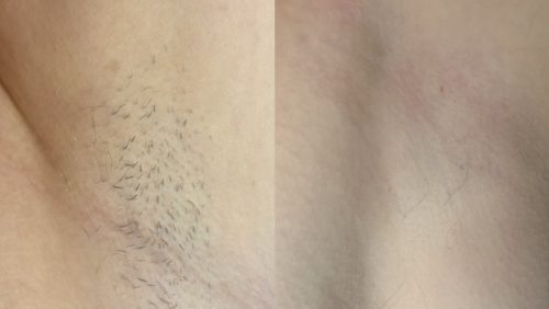 2025_07_22-Zomer-bij-Purife-stralend-glad-en-helemaal-jij