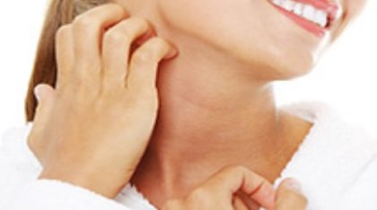 2025_09_15-Alphega-Nederweert-Schimmelinfecties-van-de-huid