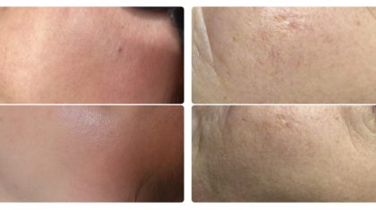 2025_09_22-Het-najaar-het-moment-om-roodheden-aan-te-pakken5