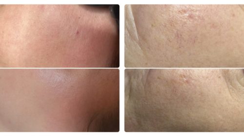 2025_09_22-Het-najaar-het-moment-om-roodheden-aan-te-pakken5