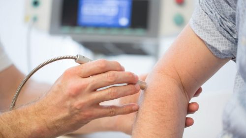 Afbeelding-Lasertherapie