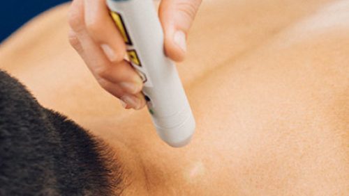 Diverse-problemen-behandeld-met-lasertherapie